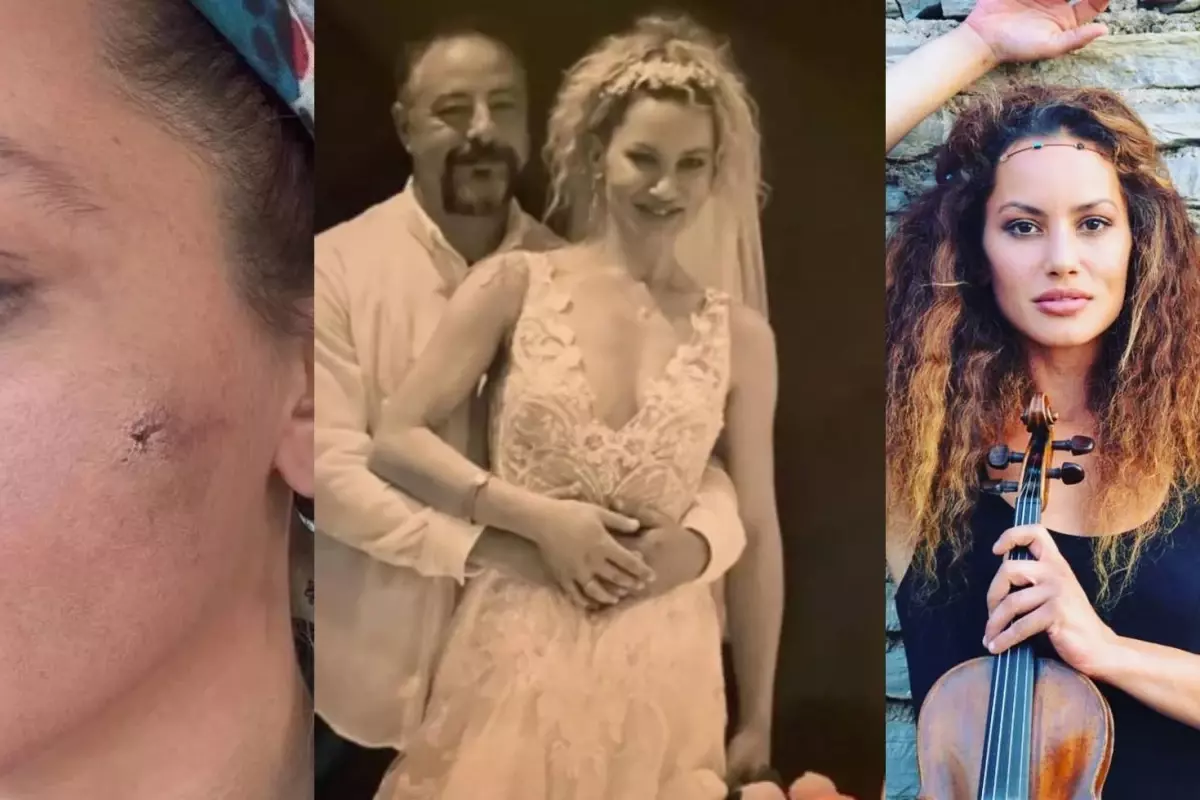 Yıldız Asyalı’nın Evde Yaşadığı Şiddet Olayı: Korkunç Anlar ve Yardım Çağrısı