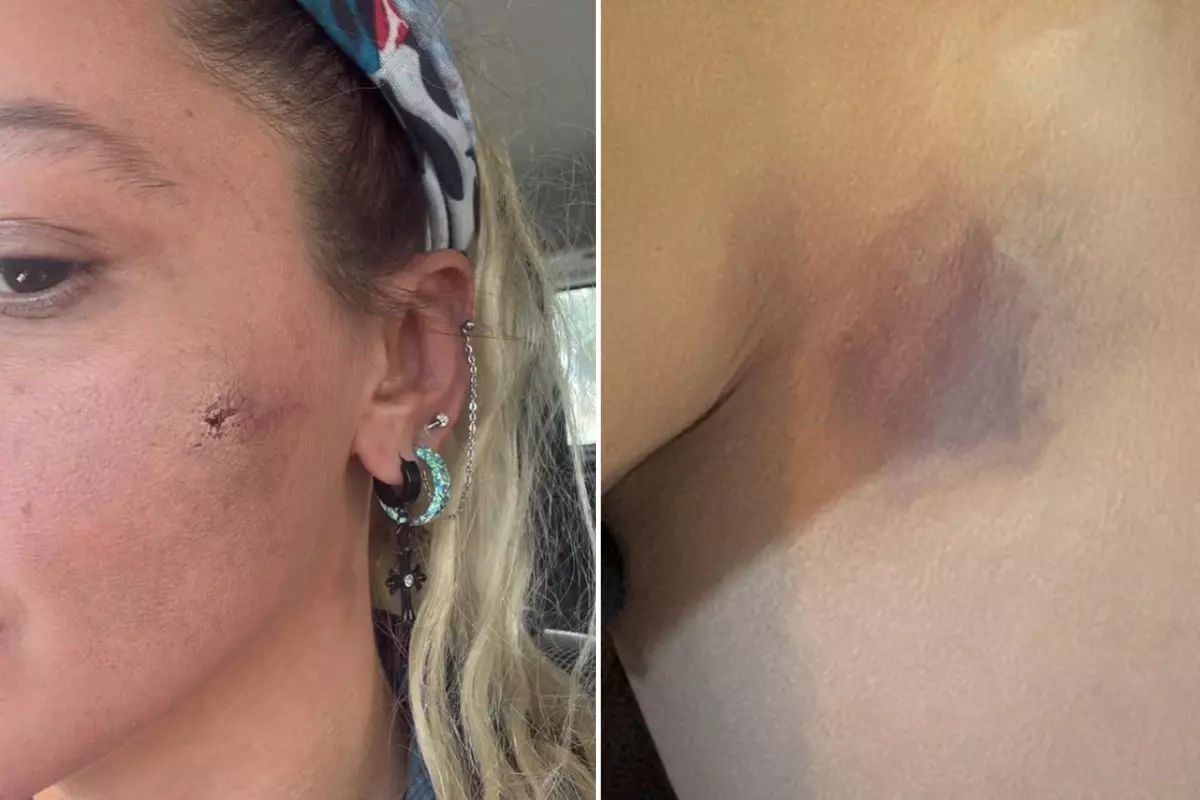 Ünlü Sanatçı Yıldız Asyalı, Eşi Tarafından Şiddete Maruz Olduğunu Sosyal Medyada Duyurdu