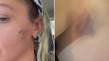 Ünlü Sanatçı Yıldız Asyalı, Eşi Tarafından Şiddete Maruz Olduğunu Sosyal Medyada Duyurdu