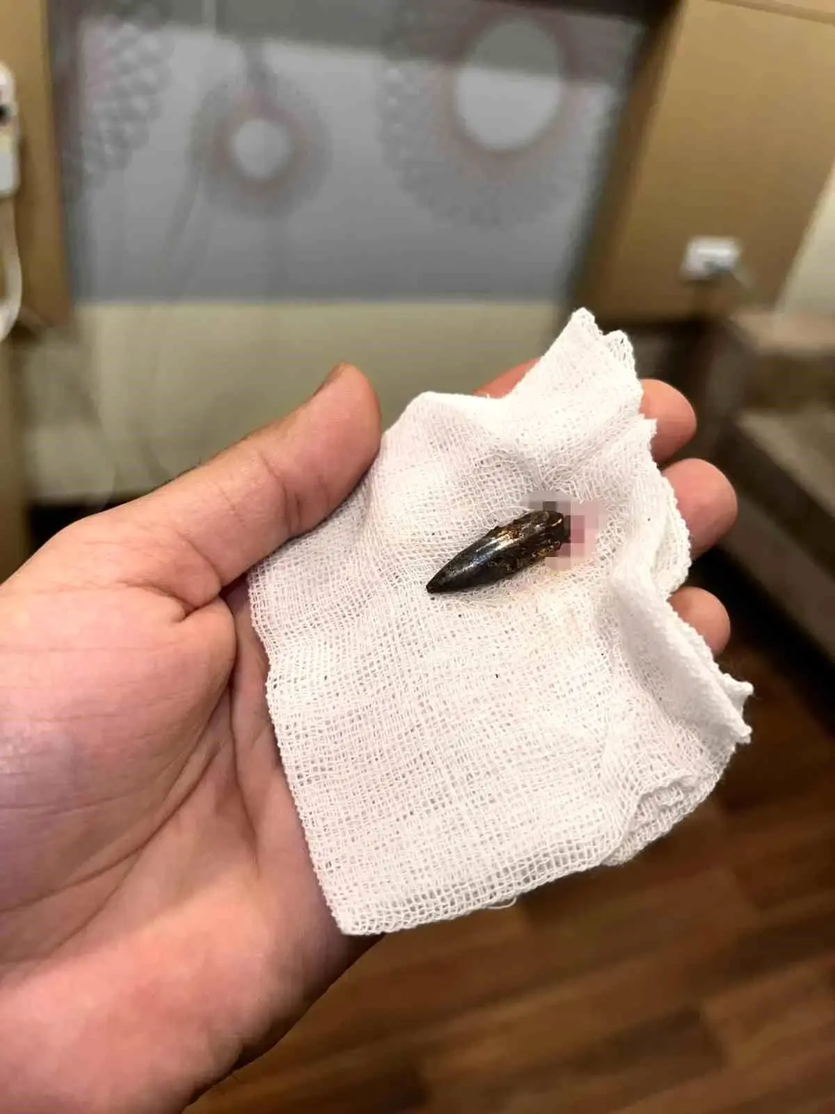 Türk Gönüllülerinin Destekleriyle Hayata Dönen Küçük Awad