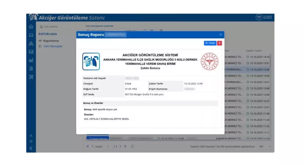 e-Nabız’da Yeni Akciğer Görüntüleme Sistemiyle TB Takibi Hızlandı