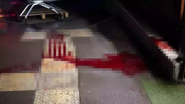 Adapazarı'nda Şiddetli Kavga: Kesici Aletle Yaralanan Kişi Polis Tarafından Sorgulanıyor