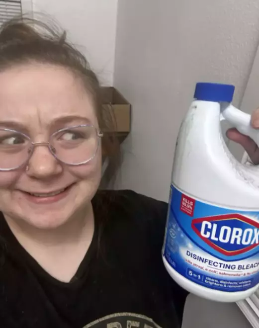 Korneal yanık görüntüsü