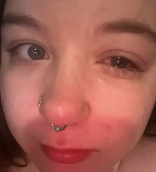 Göz yıkama prosedürü