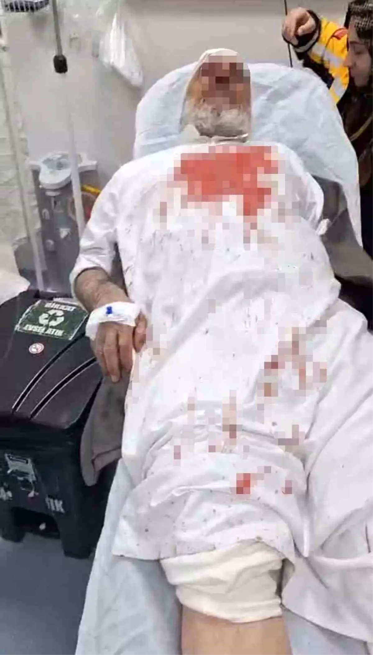 Viranşehir'de 72 Yaşındaki Adamın Saldırısı Sonuçlandı: Dört Şüpheli Tutuklandı