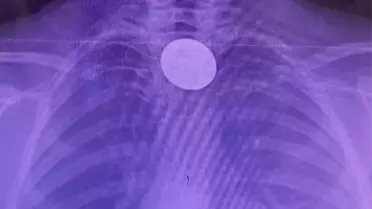 Müdahale sırasında çekilmiş fotoğraf