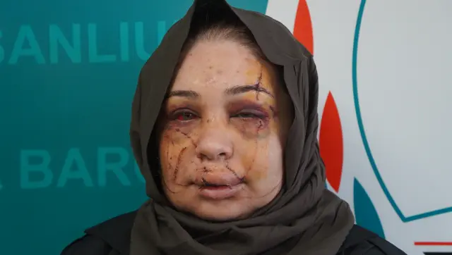 Şikayetçi kadının çektiği fotoğraf