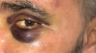 Afyonkarahisar’da Restoran Sahibi Şiddetli Saldırıyla Ağır Yaralı