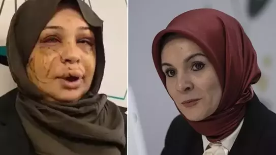 Bakan Göktaş, Şiddet Mağduru Fatma Çakmak’a Tam Destek Sözü Verdi