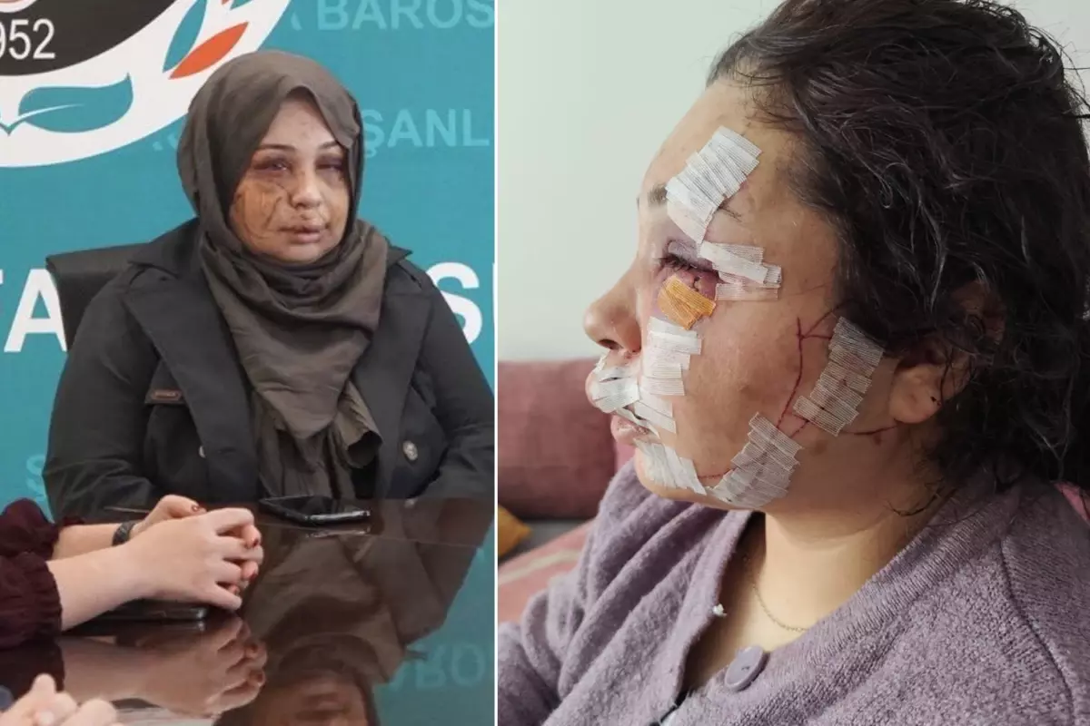 Yasin Çakmak gözaltına alındı