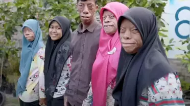 Endonezya’nın “Kertenkele Ailesi” Sosyal Medyada Küresel Fenomena Dönüştü