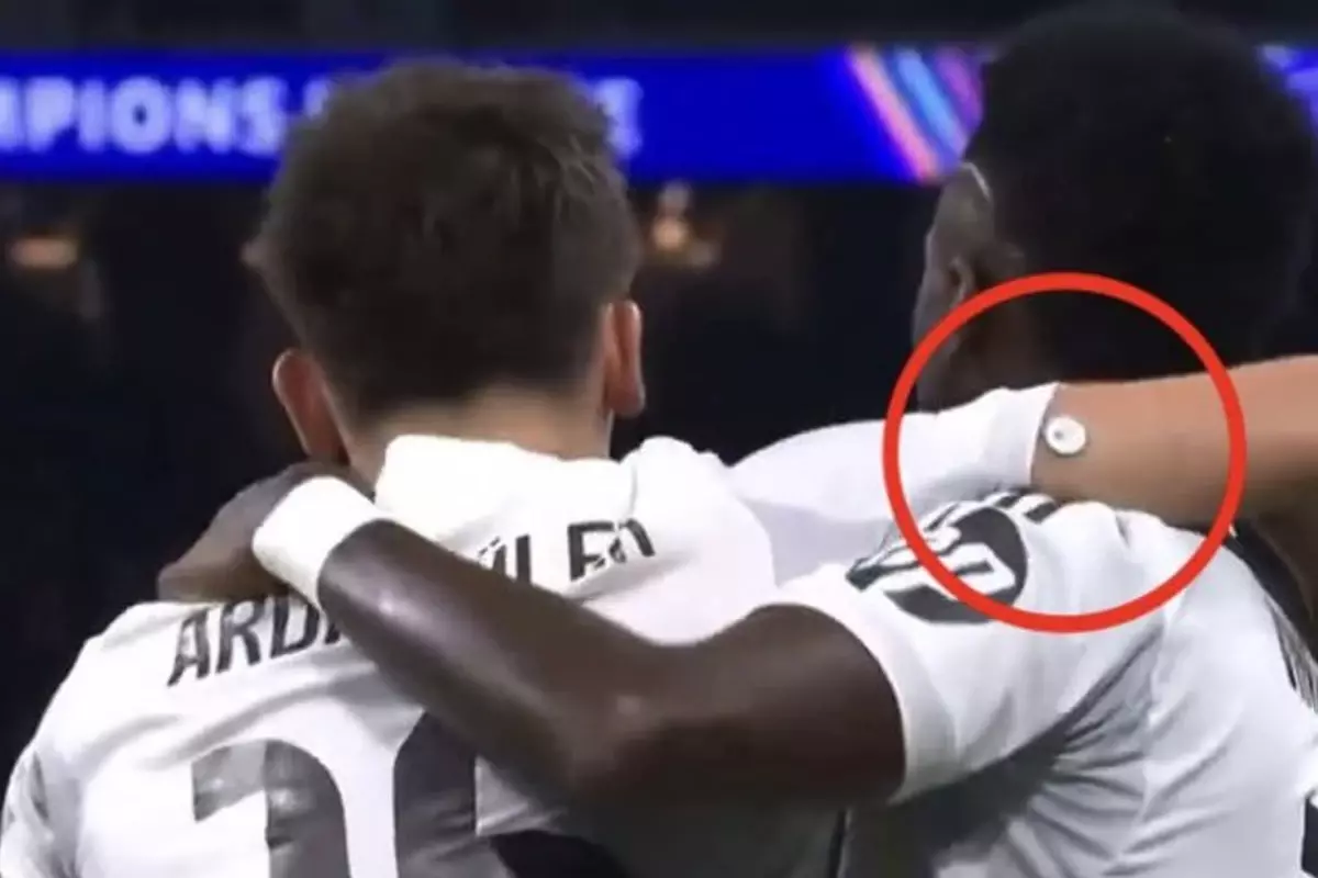 Arda Güler'in Kolundaki Glikoz Ölçer, Real Madrid-Monaco Maçında Gündemde