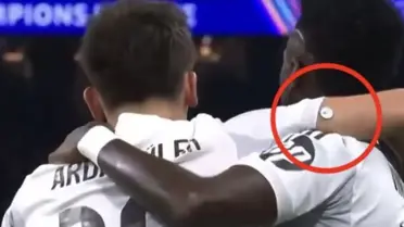 Arda Güler'in Kolundaki Glikoz Ölçer, Real Madrid-Monaco Maçında Gündemde