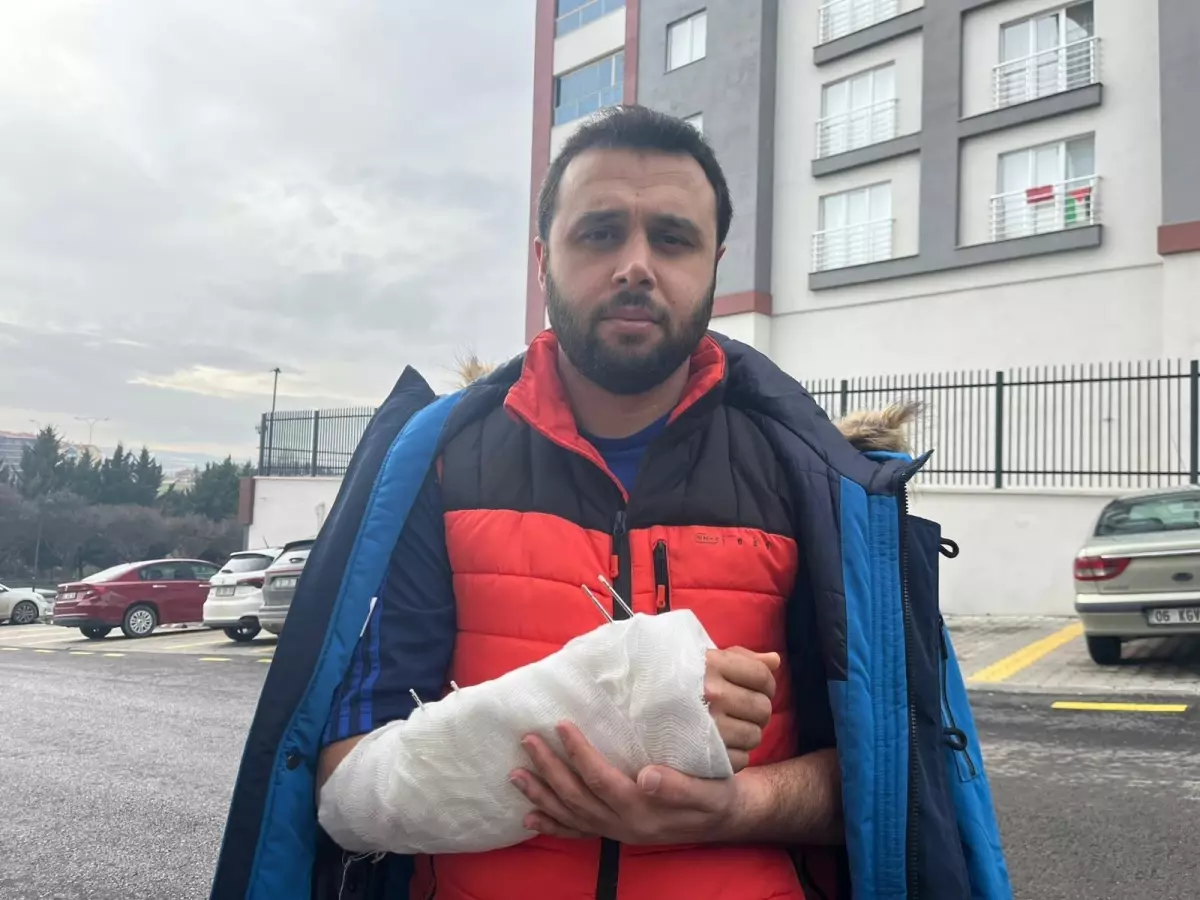 Ankara’da Sokak Köpekleri Olayı: Yasin Arslantaş Düşerek Kolunu Kırdı