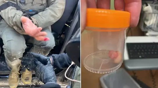 Minneapolis’ta ICE Görevlisinin Parmakları Protestocular Tarafından Isırıldı