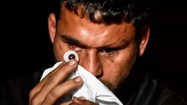Görme Yetisini Kaybeden 27 Yaşındaki Filistinli, İsrail Saldırılarında Hayatta Kalma Mücadelesi