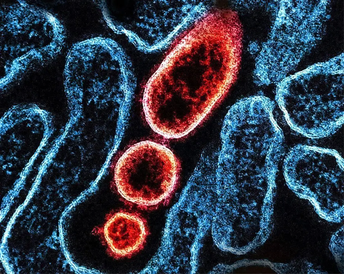 Nipah virüsü salgını