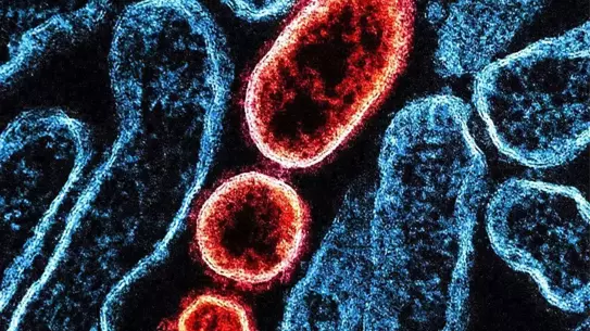 Batı Bengal'de Nipah Virüsü Salgını: 110 Kişi Karantinada