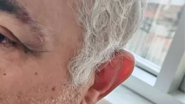 Konya’da Aile Sağlığı Merkezi’nde Müezzin ve Doktor Arasındaki Tartışma Şiddete Dönüştü