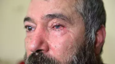 Adana’da Dolmuş Şoförünün Gözünü Kaybettiği Olay Şok Yarattı