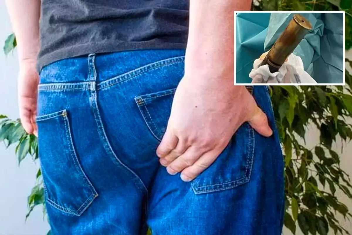 Fransa’da Hastaneye Başvuran Adamın Makatından 100 Yıllık Top Mermisi Çıktı