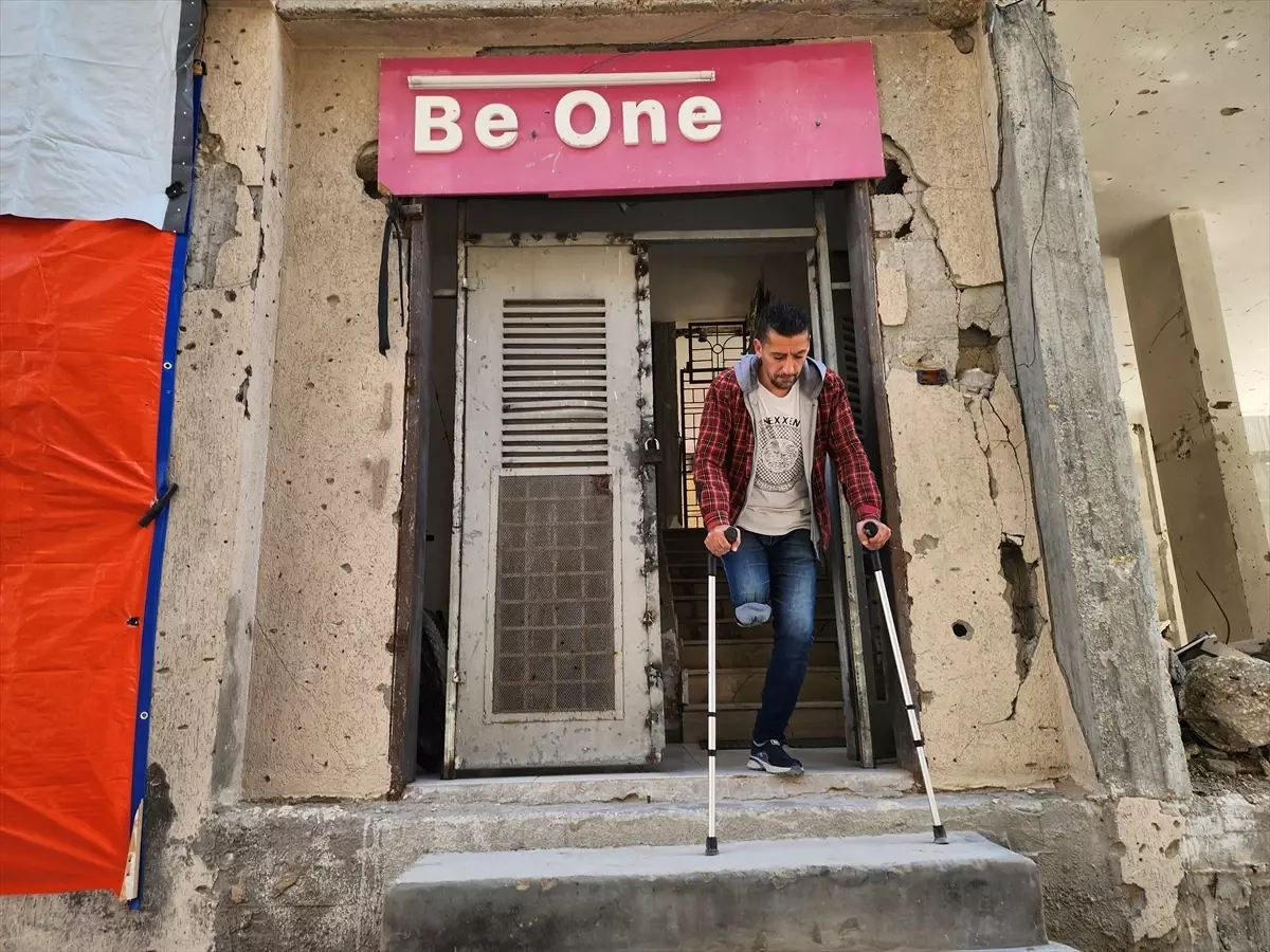 Kaybettiği Bacağını Aşan Vücut Geliştirme Antrenörü Sakr’ın İlham Verici Yolculuğu