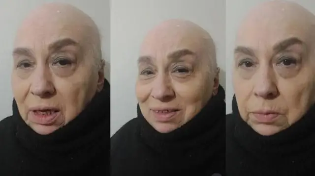 Saadet Gürses'in tedavi sürecindeki fotoğrafı