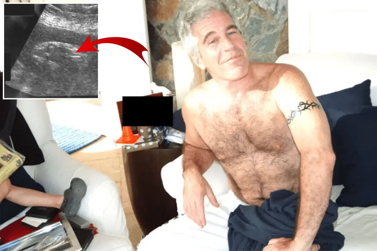 Epstein Dosyalarında Gizli Gebelik ve Ultrason Görüntüsü Ortaya Çıktı