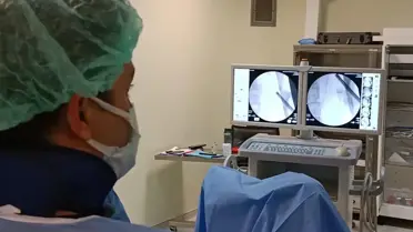 Lazer cihazı ile böbrek taşı kırma işlemi