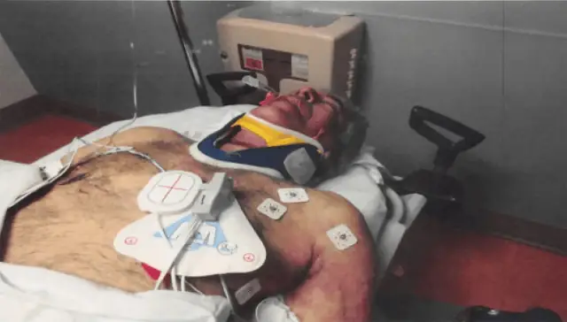 Otopsi sırasında çekilen detay fotoğrafı