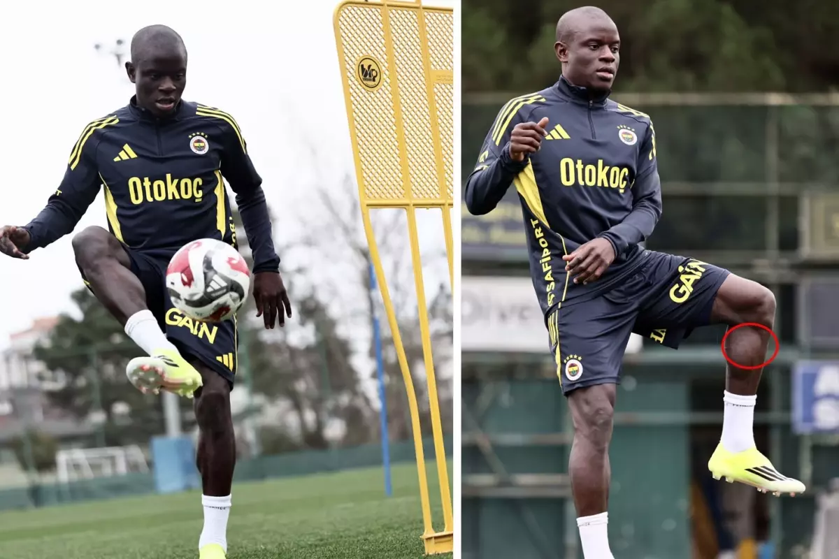 Kante, Fenerbahçe Formasıyla İlk Antrenmanını Tamamladı: Bacak Kasındaki 'A' İşareti Dikkat Çekti