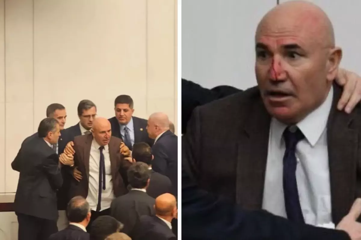 Meclis Yemin Töreninde Şok Anlar: Mahmut Tanal'ın Burnu Kanadı