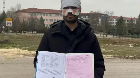 Okul Koridorunda Şok Olay: Rehber Öğretmen Fizik Öğretmenine Sıcak Çay Fırlattı