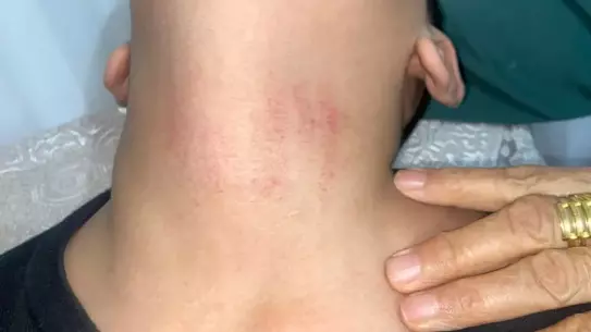 Olay yerindeki görüntü