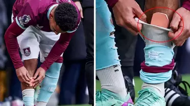 Marcus Edwards’ın maçta giydiği küçük dizlikler