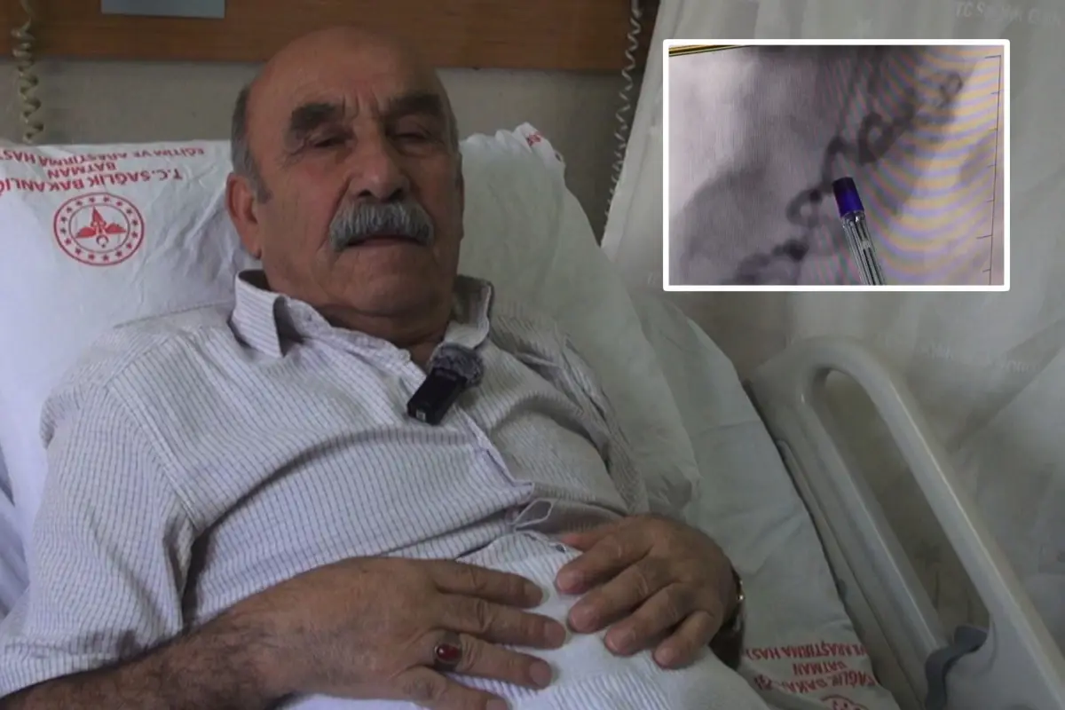 Kalbe Giden Kanı Akciğere Yönlendiren Anormal Damar Başarıyla Kapatıldı