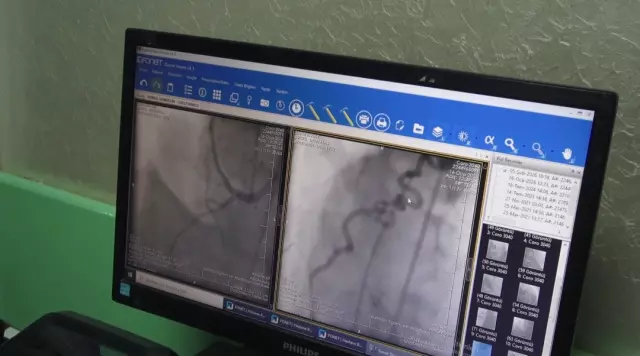 Kalp ve damar anatomisi