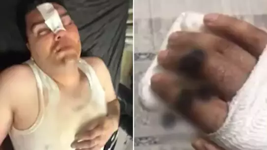 Avcılar’da 13.500 TL’lik “çerez” hesabı tartışması şiddete dönüştü