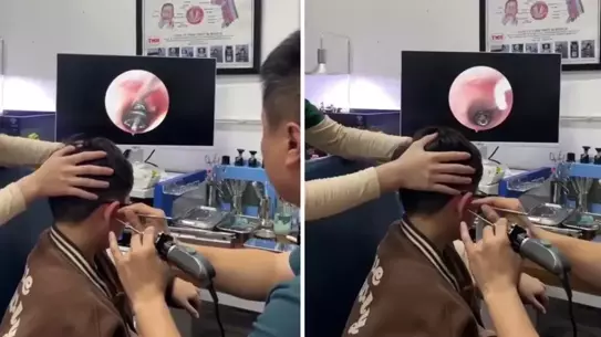 Vietnam’da Küçük Çocuğun Kulağında Bulunan Vida Şaşkınlık Yarattı