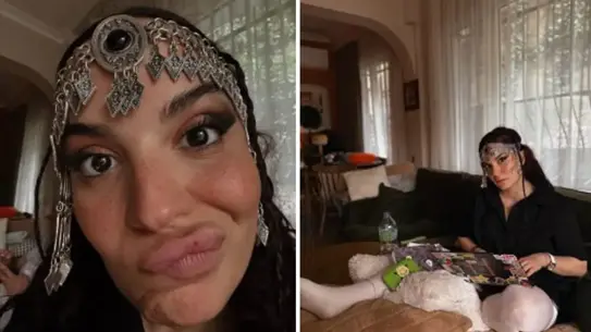 Aslı Bekiroğlu, Bağırsağı Yanlışlıkla Kesildikten Sonra 5. Ameliyatını Tamamladı ve Sağlık Durumunu Paylaştı