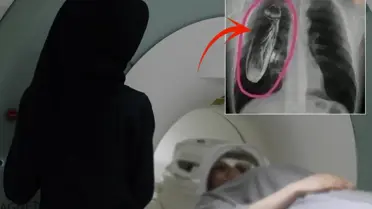 Röntgende Canlı Böcek Şaşkınlığı: Gerçek Hastanın Göğsünde Değil, Cihazda