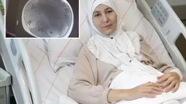 Kazakistanlı Kadının Karnındaki 45 cm'lik Dev Tümör Başarıyla Çıkarıldı