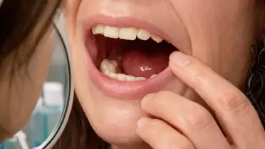 Kaplama Dişler Akciğerde Bulundu: İstanbul’da Şok Edici Medikal Vaka