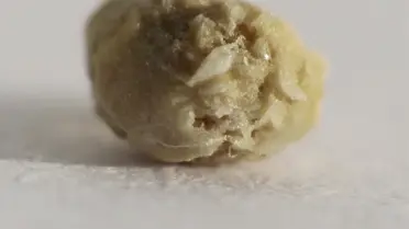 İtalyan evinde 'Mücevher' sandığı çalan hırsızlar, içinde böbrek taşları buldu