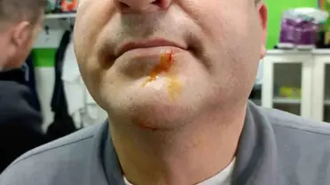 Zonguldak'ta 3. Lig Maçının Ardından Şiddetli Çatışma: 2 Gazeteci Saldırıya Uğradı, 2 Polis Yaralandı