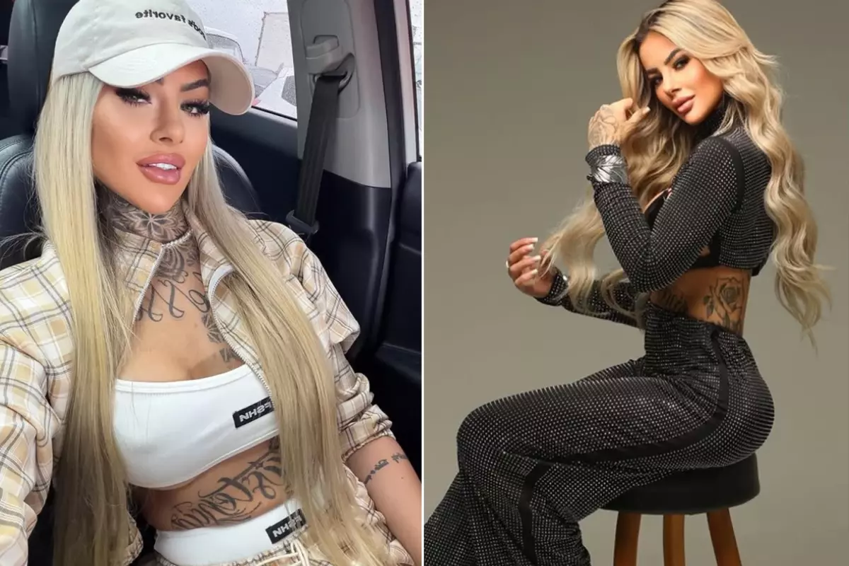 Brezilyalı Sosyal Medya Yıldızı Bianca Dias, Estetik Operasyon Sonrası Akciğer Embolisiyle Hayatını Kaybetti