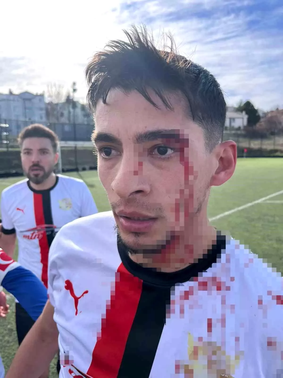 Bilecik'te Amatör Futbol Maçını Takiben Çıkan Kavga 3 Yaralıyla Sonuçlandı