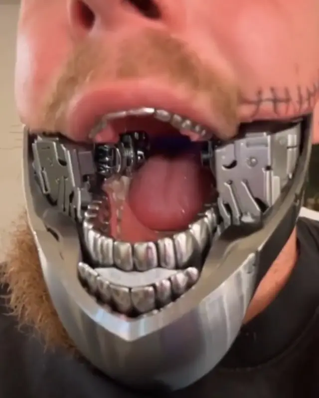 Jake Paul ameliyat öncesi