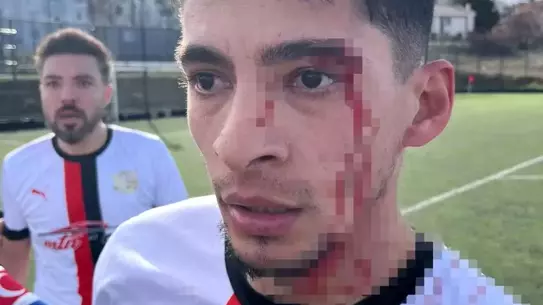 Maç sonrası sahada yaşanan kavga