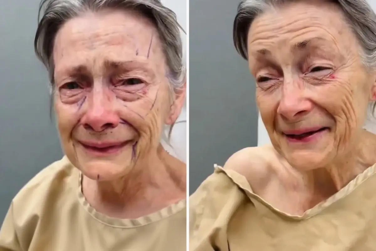 Kadının operasyon öncesi ve sonrası görünümleri